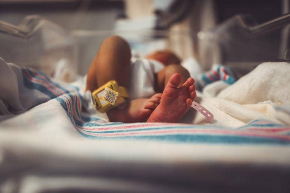 Anencephaly: Penyebab, Gejala, Penanganan, Pencegahan | IDN Times