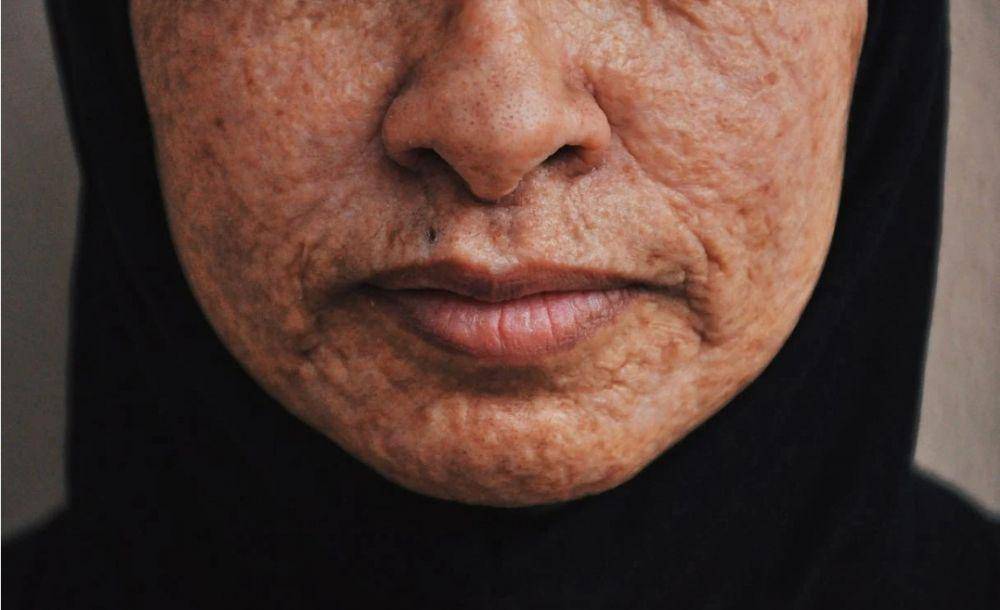 kulit cepat keriput jika berlama-lama di ruangan ber-AC (pexels.com/Andy)