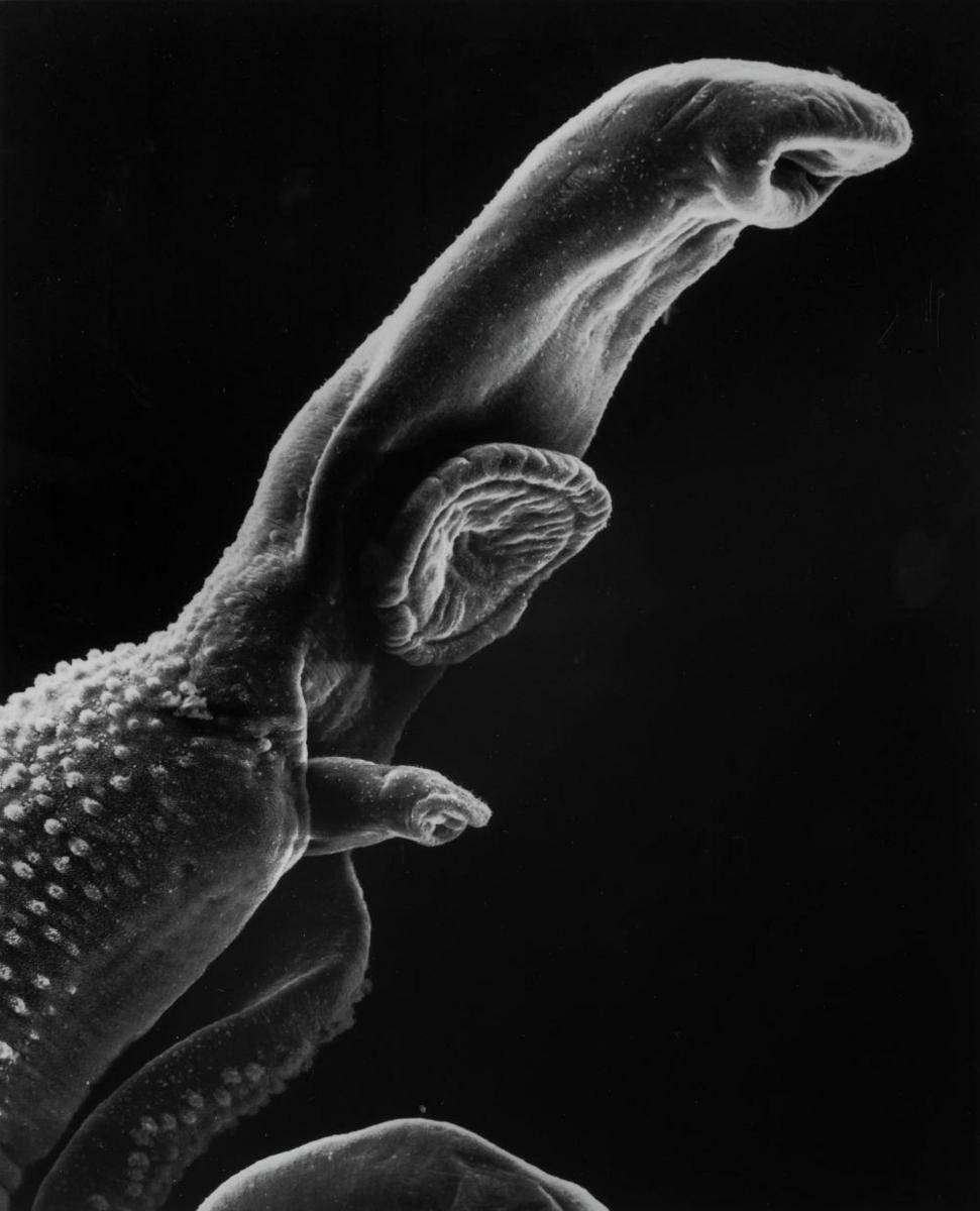 ilustrasi parasit schistosome (unsplash.com/National Cancer Institute)