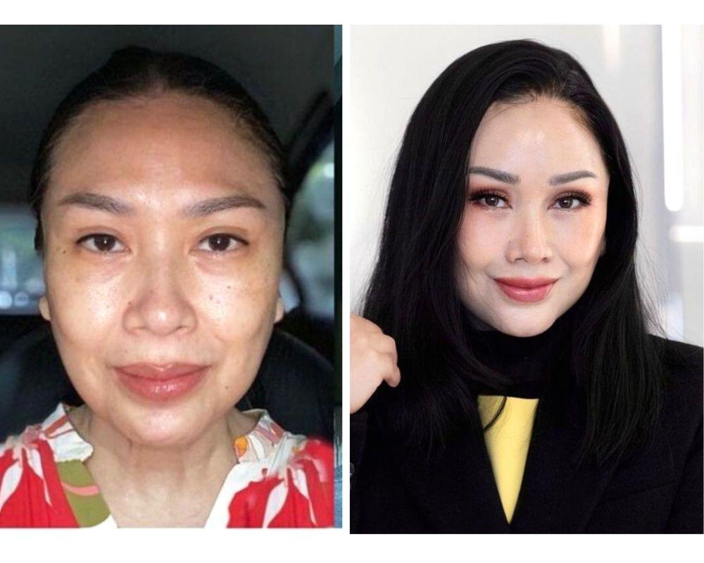 10 Potret Titi DJ Pamer Wajah Usai Oplas, Netizen: Kayak Beda Orang!