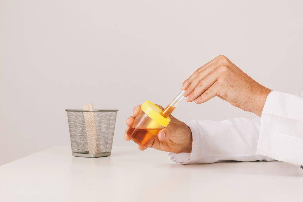 ilustrasi darah dalam urine (freepik.com/freepik)