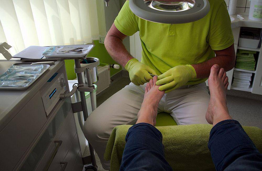 ilustrasi pengobatan kutil plantar (pixabay.com/HansLinde)