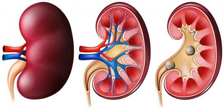 ilustrasi organ ginjal (freepik.com/brgfx)