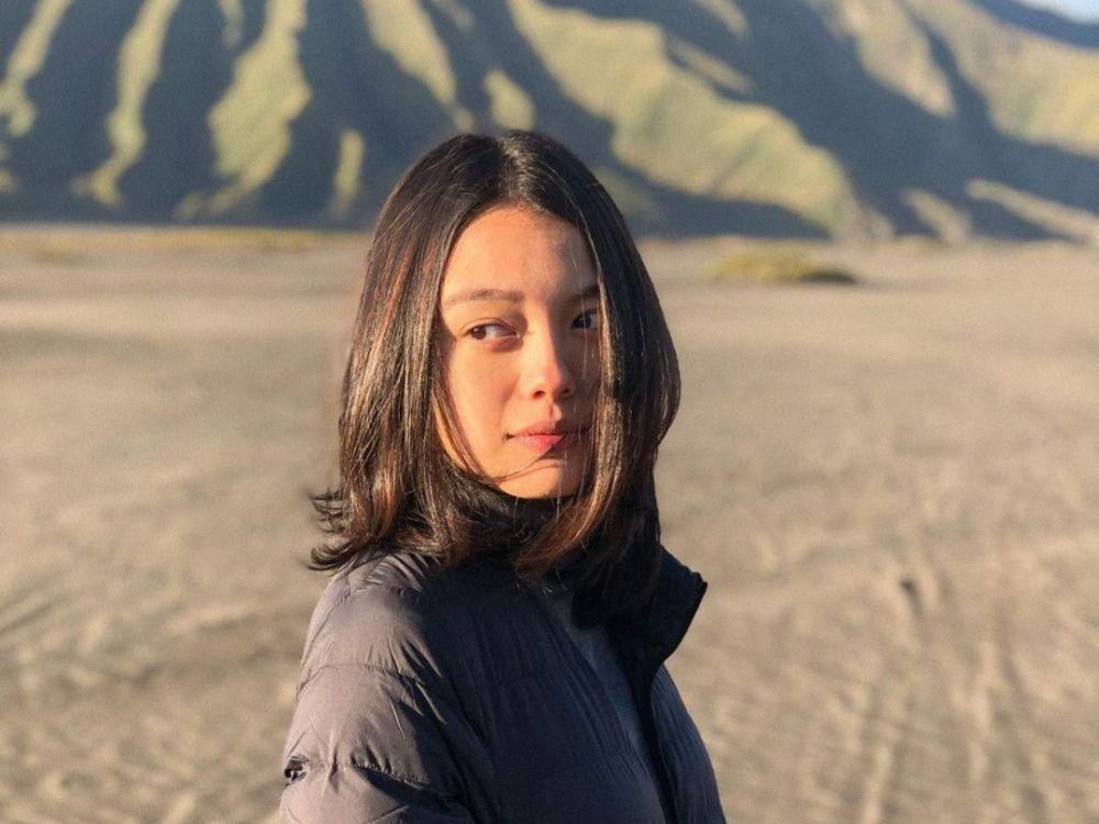 10 Potret Bianca Alianajla, Dokter Muda Calon Menantu Meriam Bellina