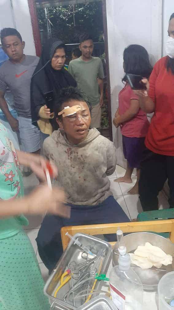 Pelaku dugaan penculikan anak babak belur diamuk massa dan mendapat perawatan medis (Dok.IDN Times)