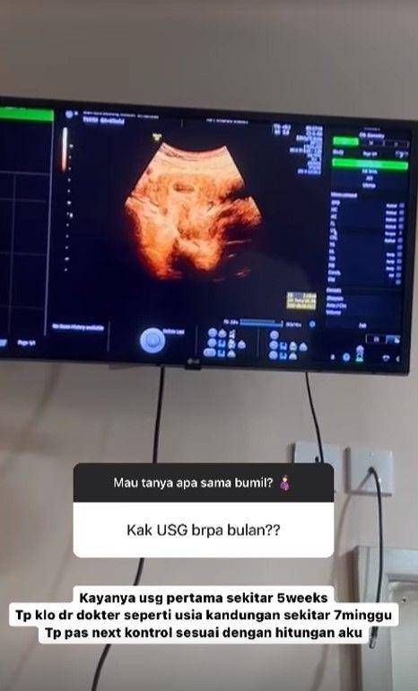 Ryana Dea umumkan kehamilan (Instagram.com/ryana_dea)