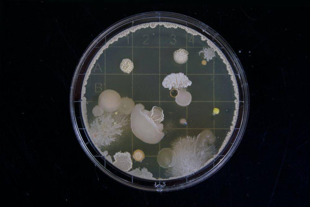 Ilustrasi bakteri penyebab leptospirosis. (Unsplash.com/Michael Schiffer)