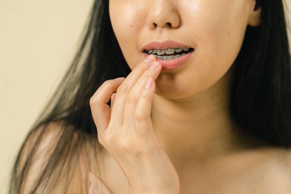 5 Tips Mengatasi Bibir Kering dan Pecah-Pecah