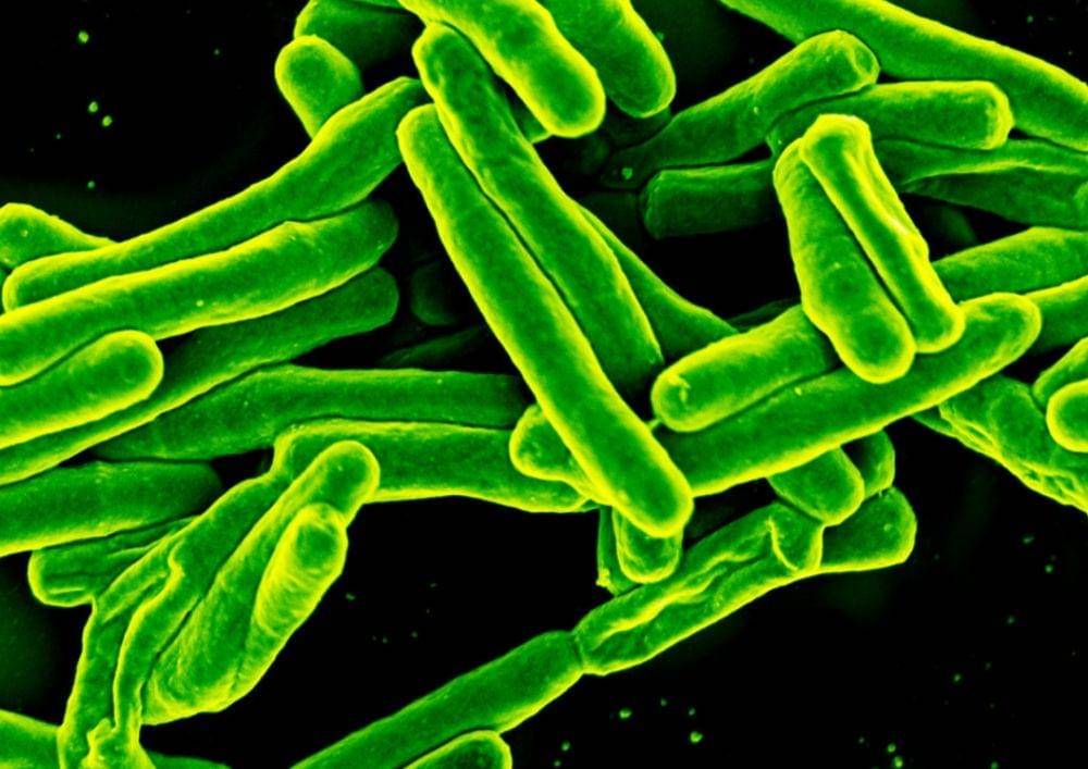 Bakteri Mycobacterium tuberculosis penyebab TBC.