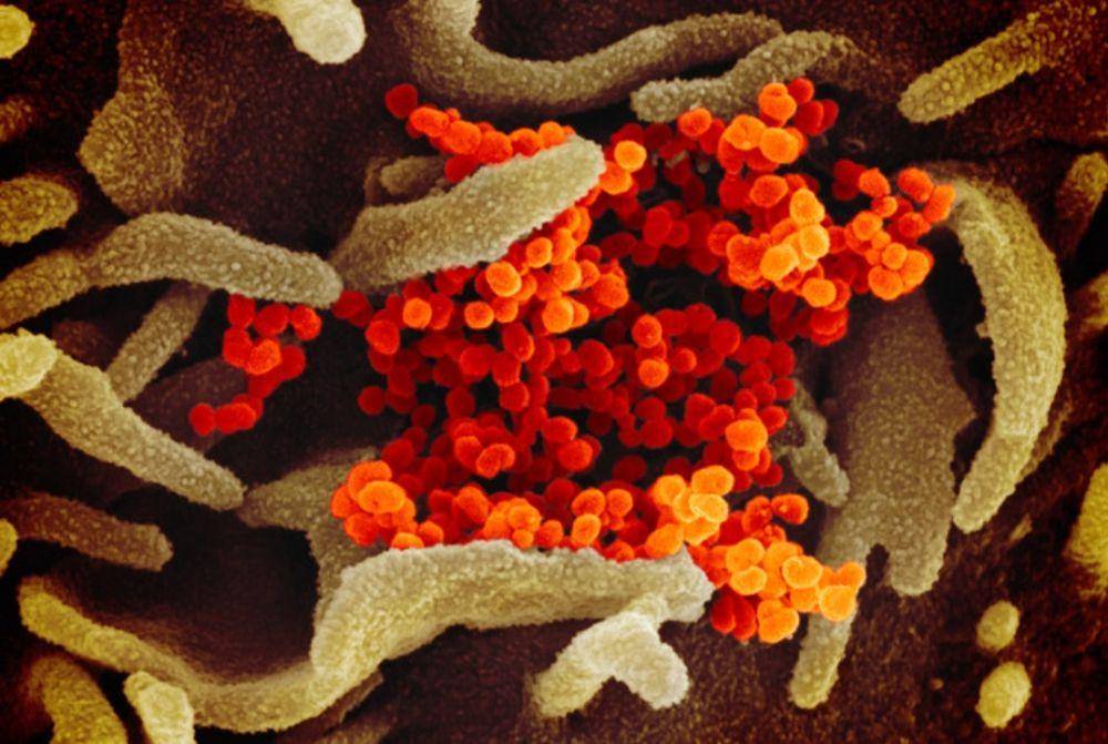 ilustrasi virus (flickr.com/NIAID)