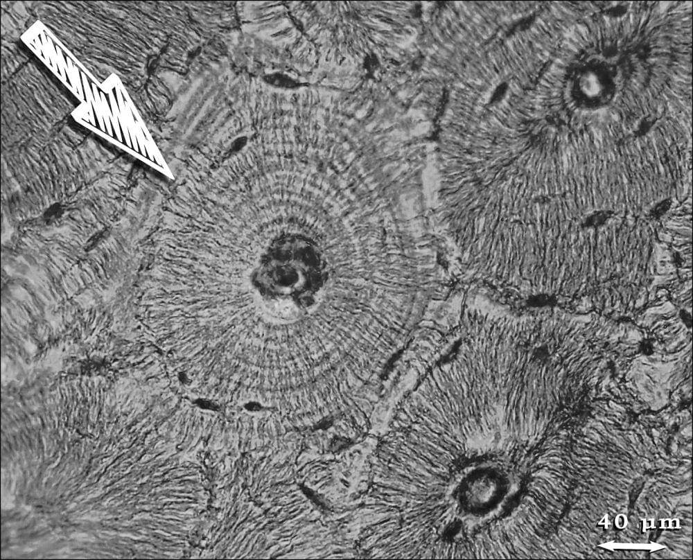 ilustrasi osteon (commons.wikimedia.org/Katsamenis)
