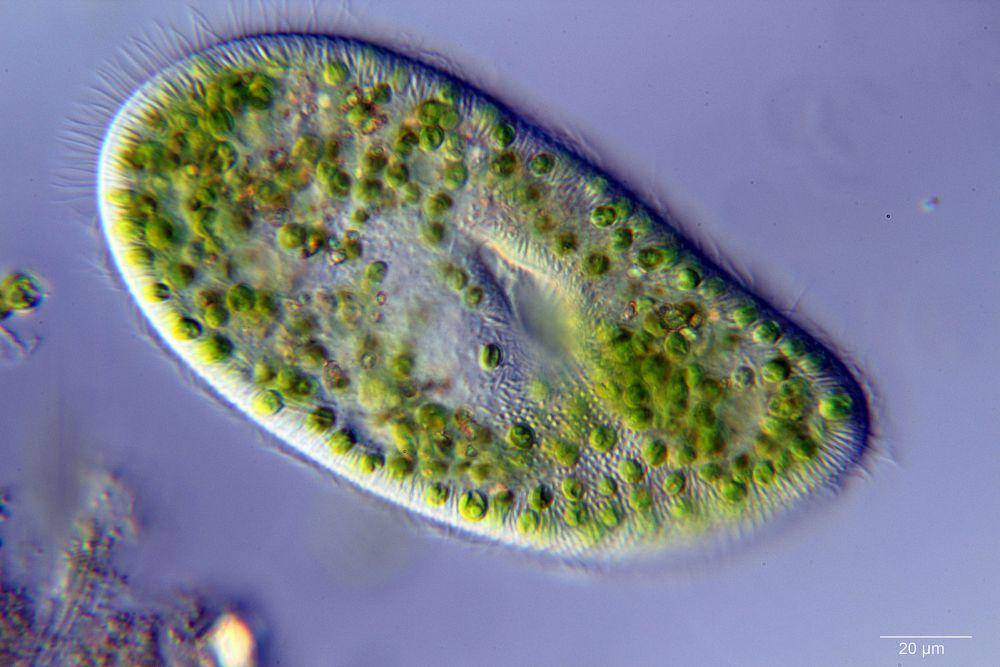 ilustrasi ciliata (common.wikimedia.org/Anatoly Mikhaltsov)