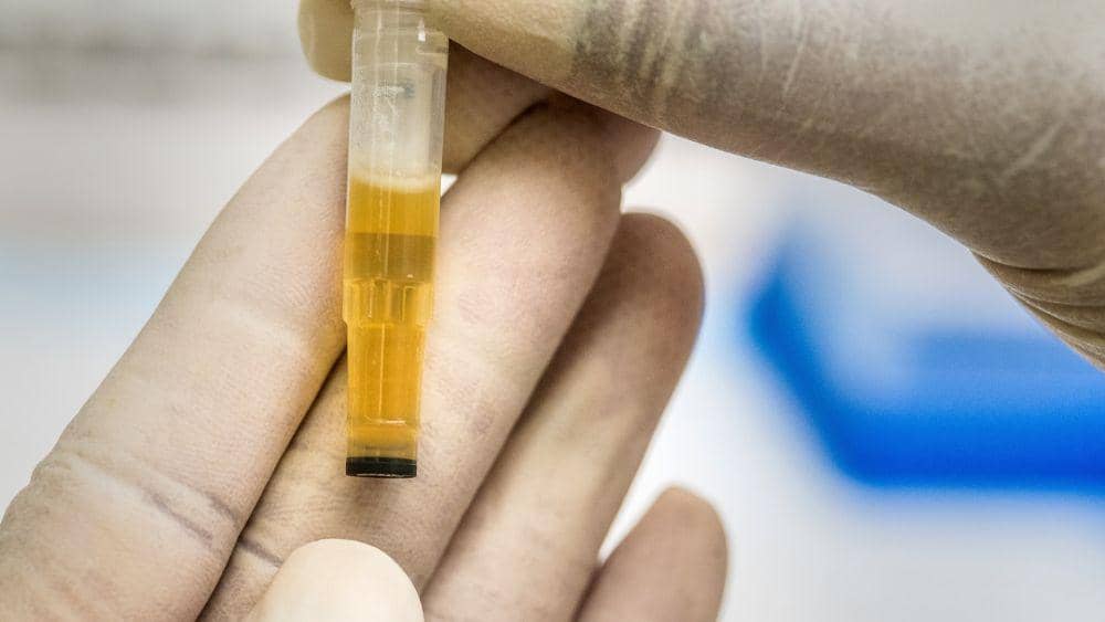 ilustrasi tes urin (unsplash.com/CDC)