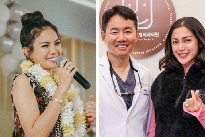 artis yang pernah operasi hidung (instagram.com/inijedar | instagram.com/nikitamirzanimawardi_172)