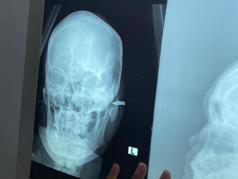 Istri Disebut Pelacur, Pria di Mesuji Tembak Temannya