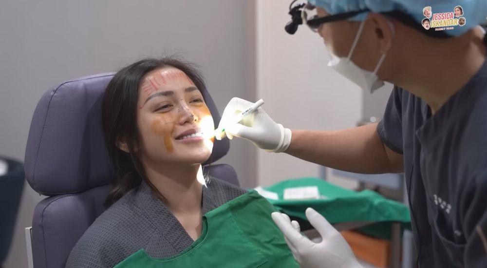Jessica operasi hidung (YouTube.com/Jessica Iskandar)