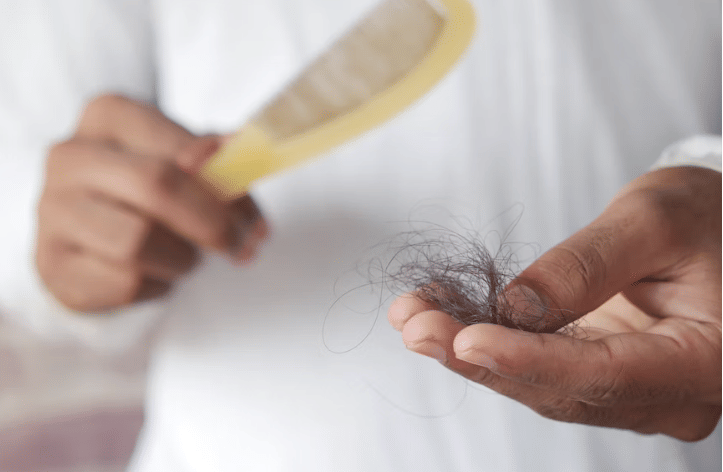 ilustrasi rambut rontok