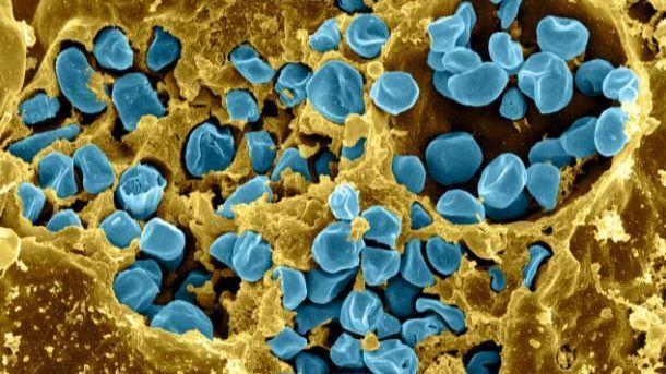 Bakteri Francisella tularensis strain LVS (berwarna biru) yang menyebabkan penyakit tularemia. (commons.wikimedia.org/NIAID)