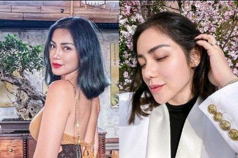 10 Potret Jessica Iskandar Pasca Operasi Hidung, Banjir Kritikan!
