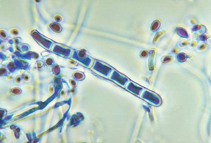 ilustrasi jamur Trichophyton di bawah mikroskop (CDC/Dr. Libero Ajello)