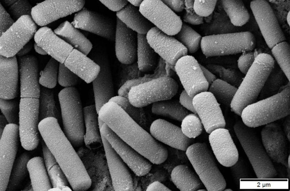 ilustrasi bakteri Bacillus cereus (commons.wikimedia.org/Mogana Das Murtey and Patchamuthu Ramasamy)