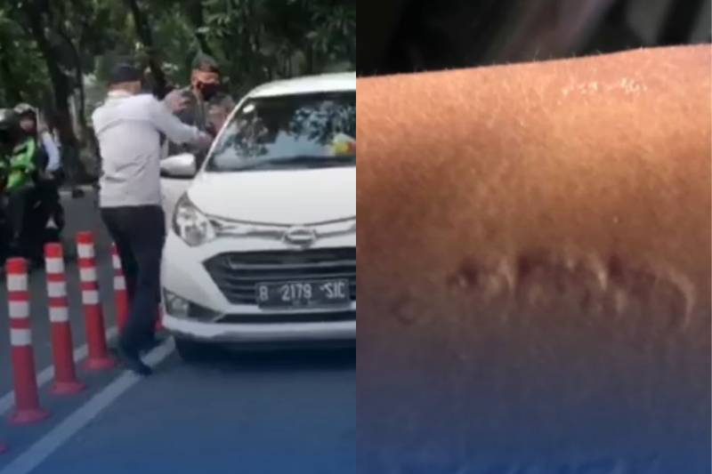 Petugas Dishub digigit Pengemudi Mobil Taksi Online saat hendak ditertibkan. (instagram.com/dishubjaksel)