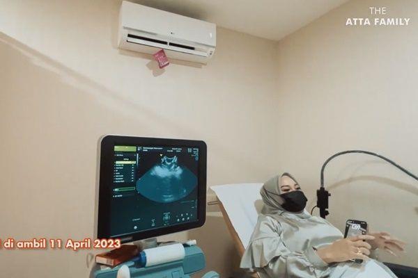 Aurel USG pertama kali (YouTube.com/Atta Halilintar)