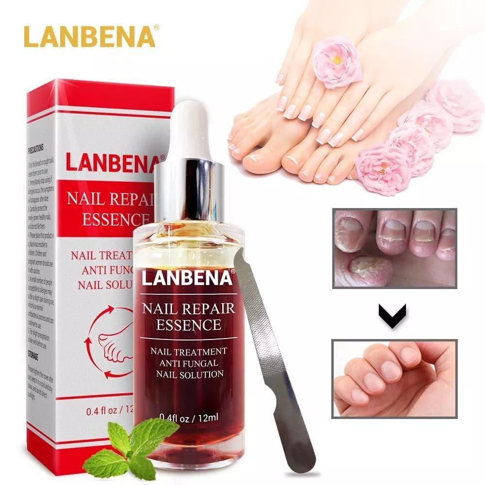 Potret Lanbena Nail Repair Essence (shopee.co.id/meltblown)