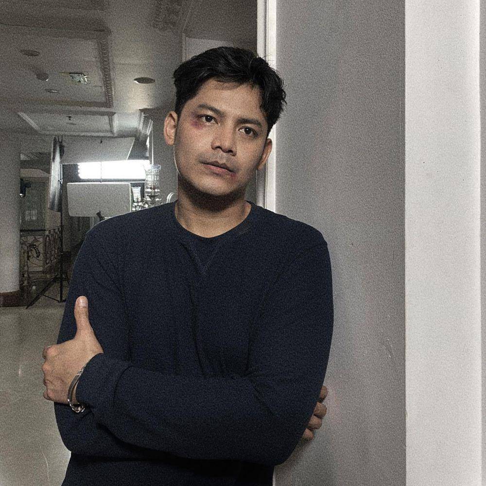 artis alami kecelakaan di 2023 (instagram.com/fikialman)