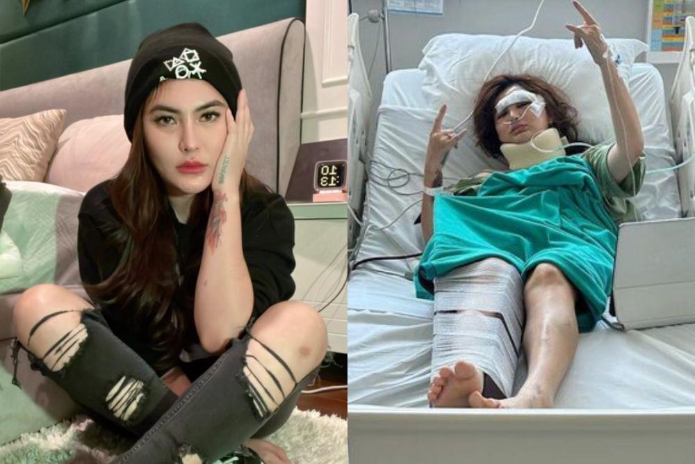 Kronologi Angela Lee Kecelakaan Sampai Harus Pasang Pen di Kaki