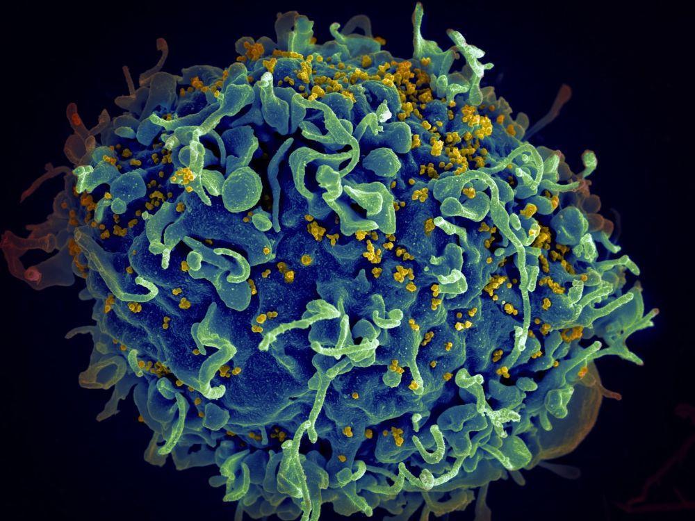 Lama Masa Inkubasi HIV, Mingguan atau Bulanan?