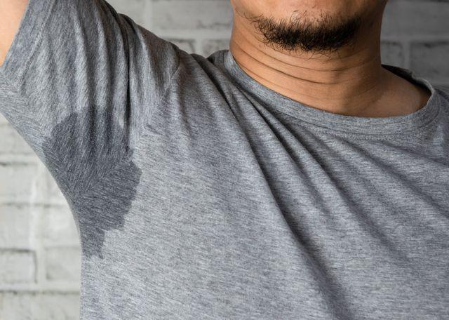 Keringat Berlebih (Hiperhidrosis): Penyebab, Komplikasi, Pengobatan
