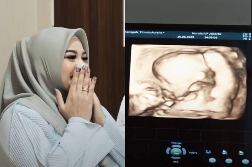 momen Aurel lakukan USG (youtube.com/attahalilintar)