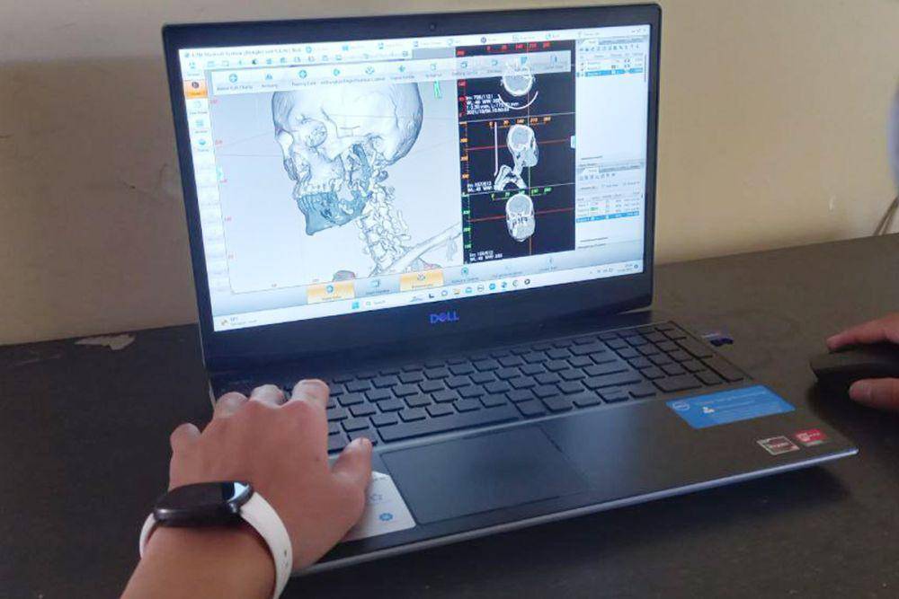 Tim Widya Imersif Teknologi sedang mengolah file hasil pemeriksaan MRI sebelum masuk pada proses pencetakan organ tiruan. (Dok. Istimewa)
