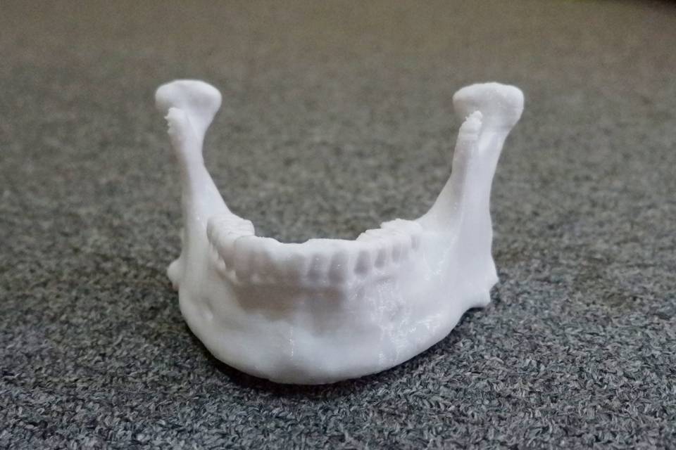 Organ buatan hasil pencetakan menggunakan E3D. (Dok. Istimewa)