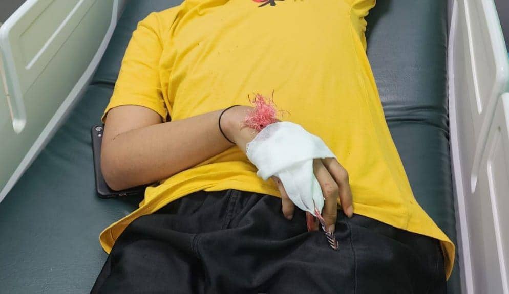 Seorang pemuda di Makassar terkena anak panah yang dilepaskan geng motor. (Istimewa)