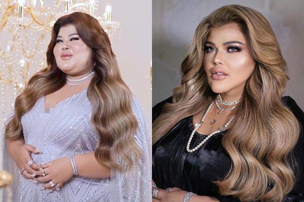 Turun 30 Kg, 8 Potret Shindy Samuel Usai Operasi Potong Lambung