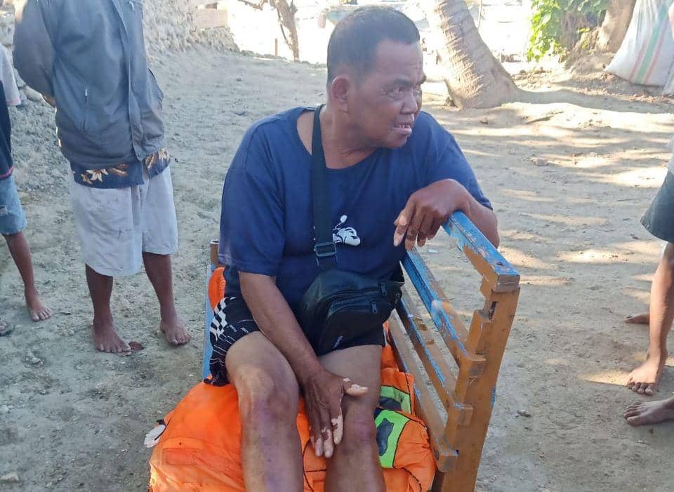 Korban yang mengalami cedera pada kaki (dok. Narasumber/ Saeful Rahman)