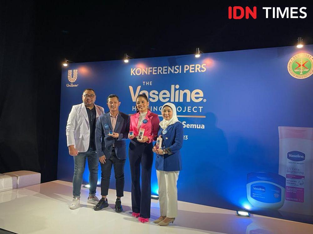 Cantika Abigail Bagikan Pengalaman sebagai Psoriasis Warrior, Berat!