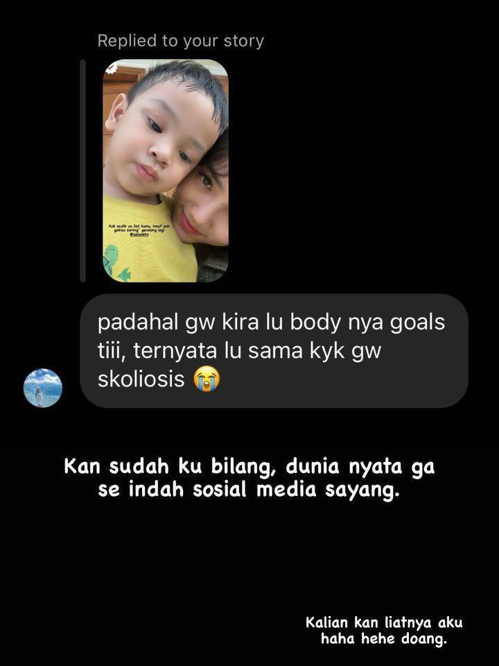 Fuji curhat idap skoliosis (instagram.com/fuji_an)