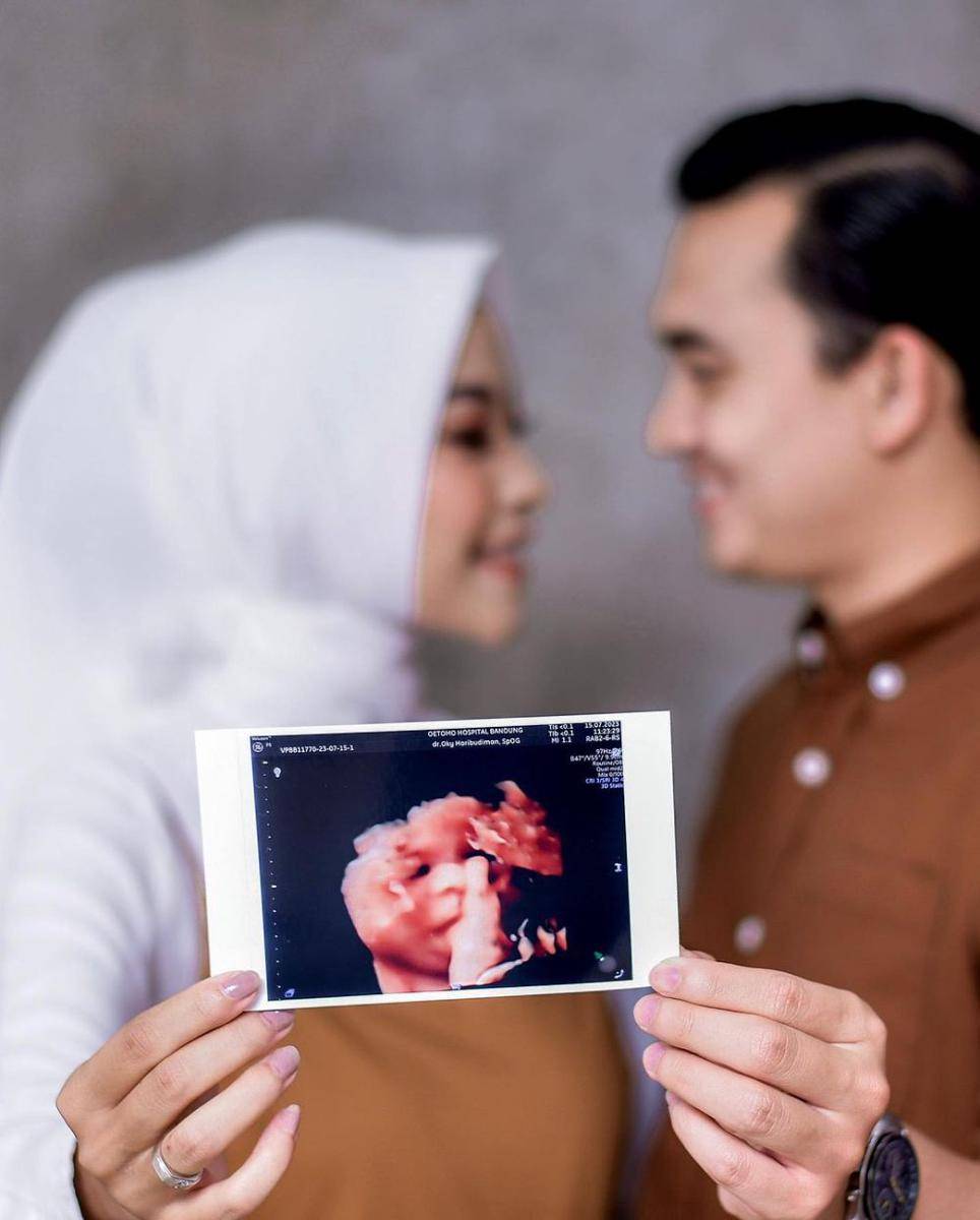 momen maternity shoot Ikbal Fauzi dan istri (instagram.com/ikbalfauzi_)