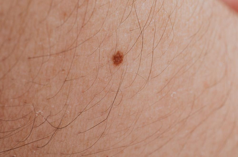 Kenapa Rambut Tangan dan Kaki Tidak Pernah Tumbuh Panjang?