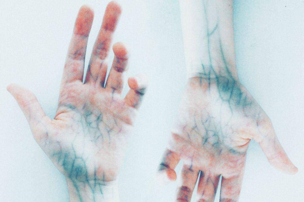 ilustrasi pembuluh darah (pexels.com/Elīna Arāja)