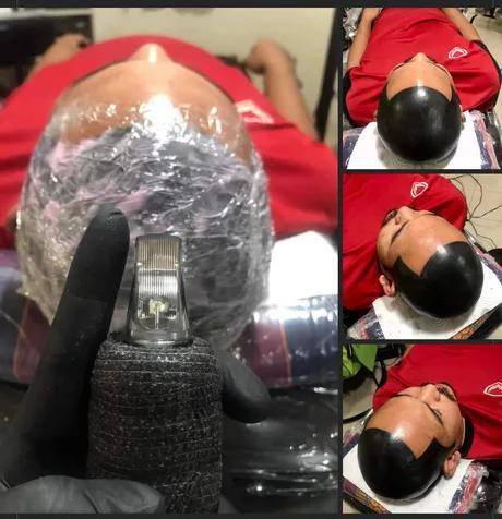 potret tato nyeleneh di bagian kepala (reddit.com/user/number-one-jew)