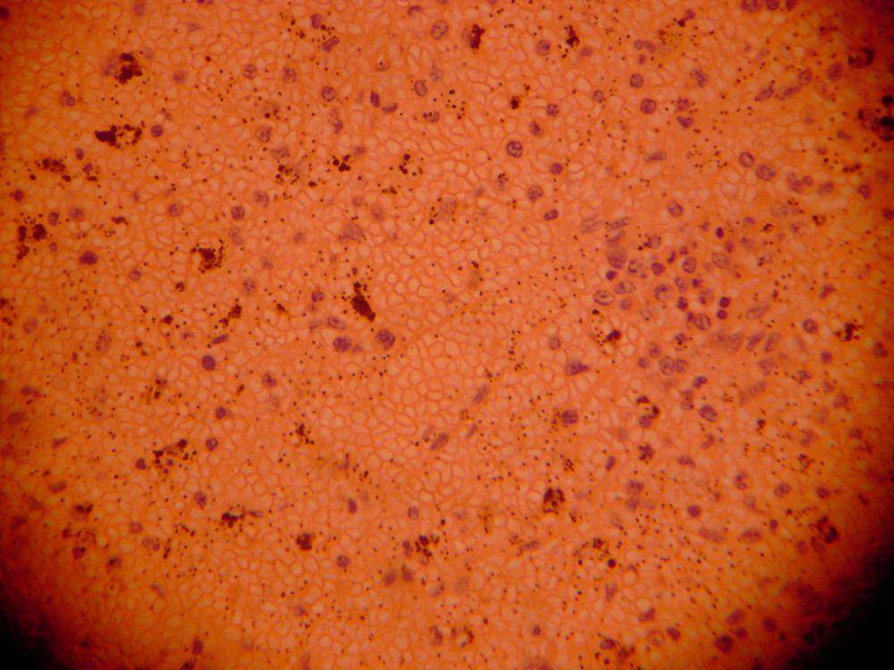 Plasmodium malariae (commons.wikimedia.org/Michael Wunderli)