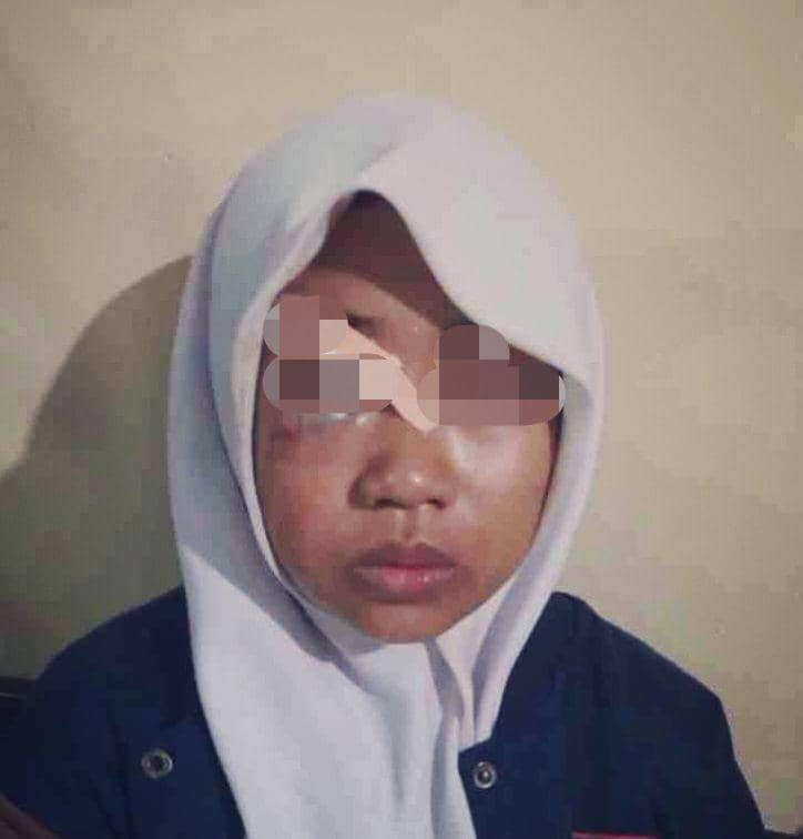 Zukhruf Muzzammil, siswi SMK korban perampokan. (Dok. Polsek Purwodadi)