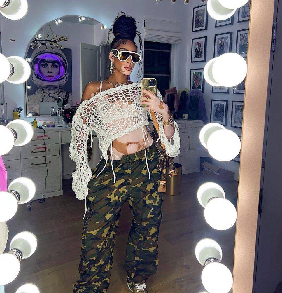 Winnie Harlow (instagram.com/winnieharlow)