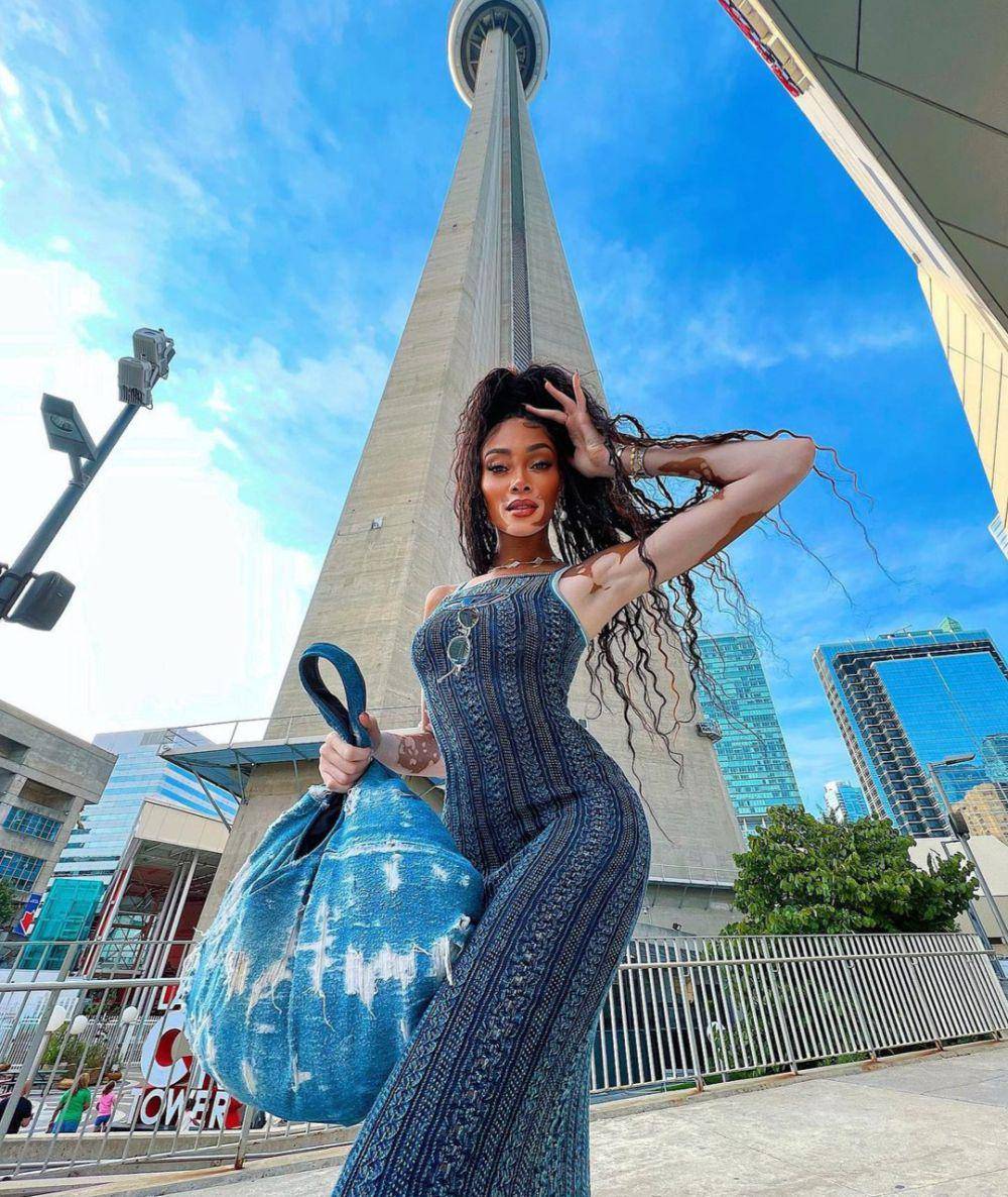 Winnie Harlow (instagram.com/winnieharlow)