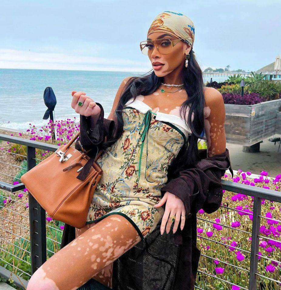 Winnie Harlow (instagram.com/winnieharlow)