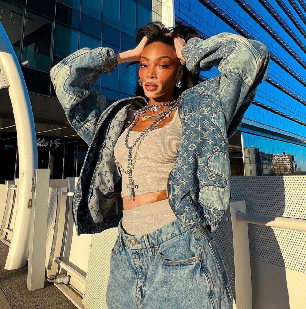 Winnie Harlow (instagram.com/winnieharlow)